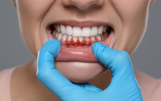 Close-up of a dental professional wearing blue gloves pulling down a patient’s lower lip to reveal red, inflamed gums, illustrating signs of gum disease.